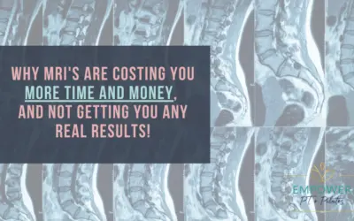 Do you need an MRI for back pain?